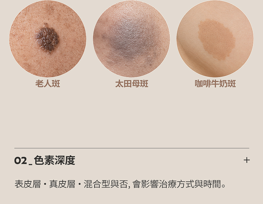 真皮性深層色素治療