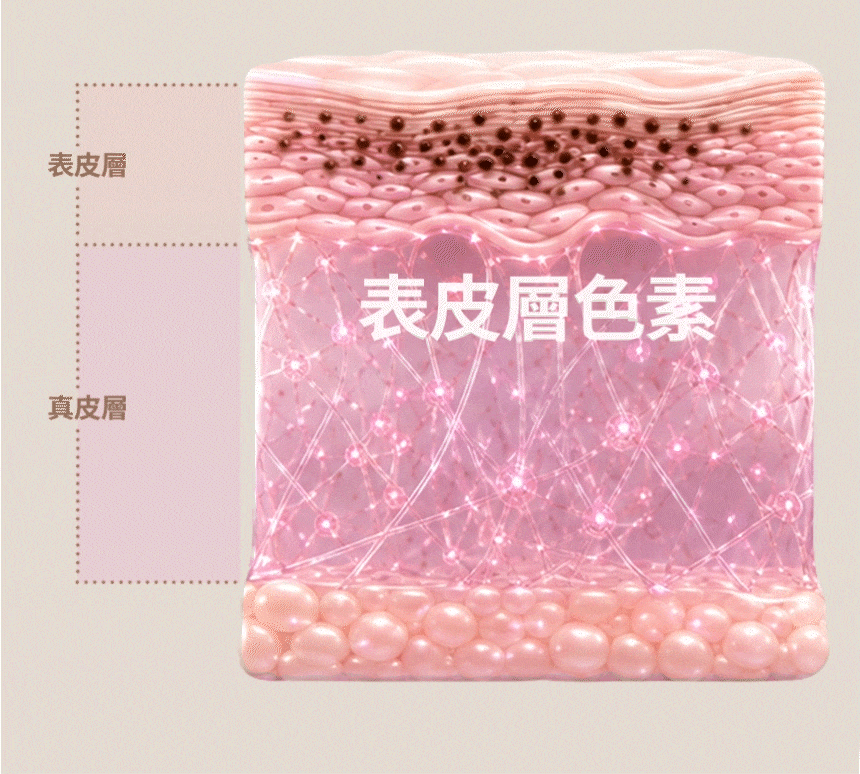肝斑·黑子·雀斑等色素類型