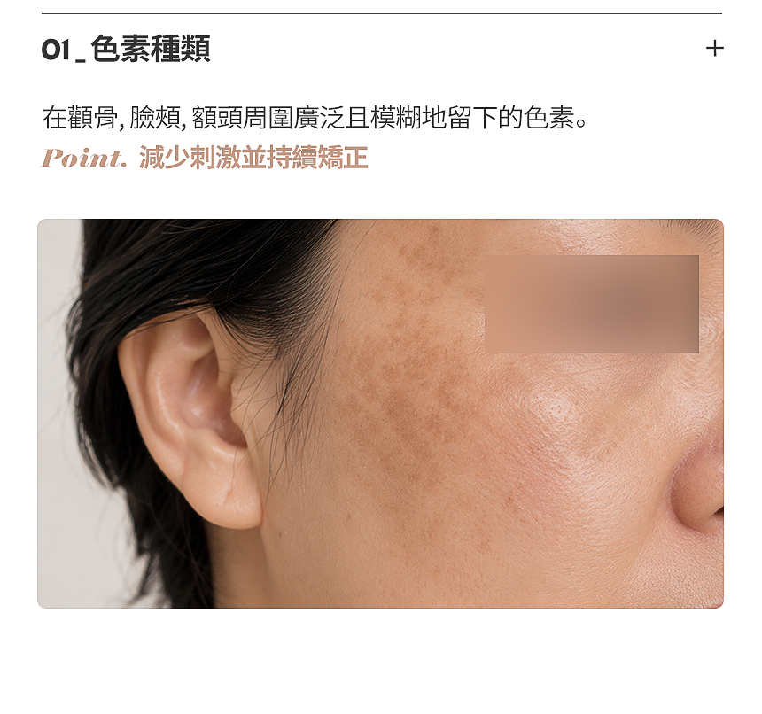 FLORIA 肝斑·黑子·色素雷射治療