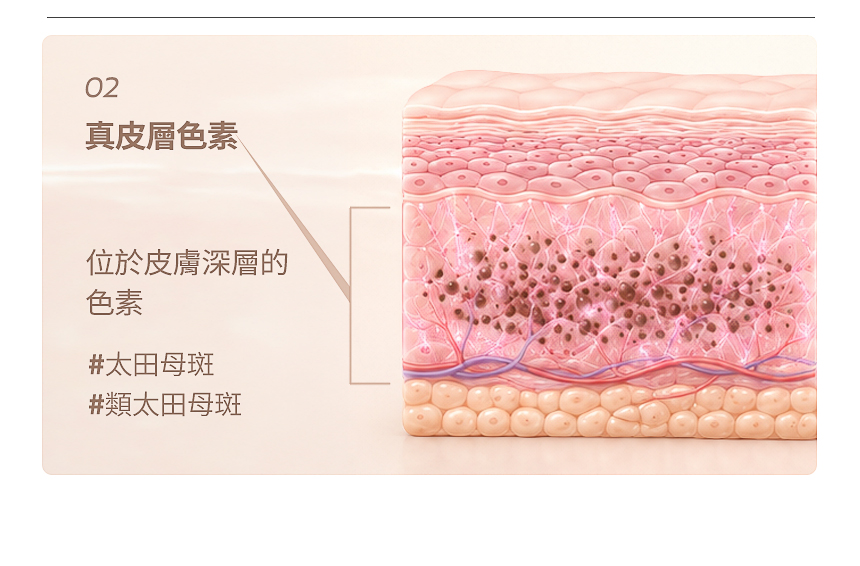 真皮性深層色素客製化治療