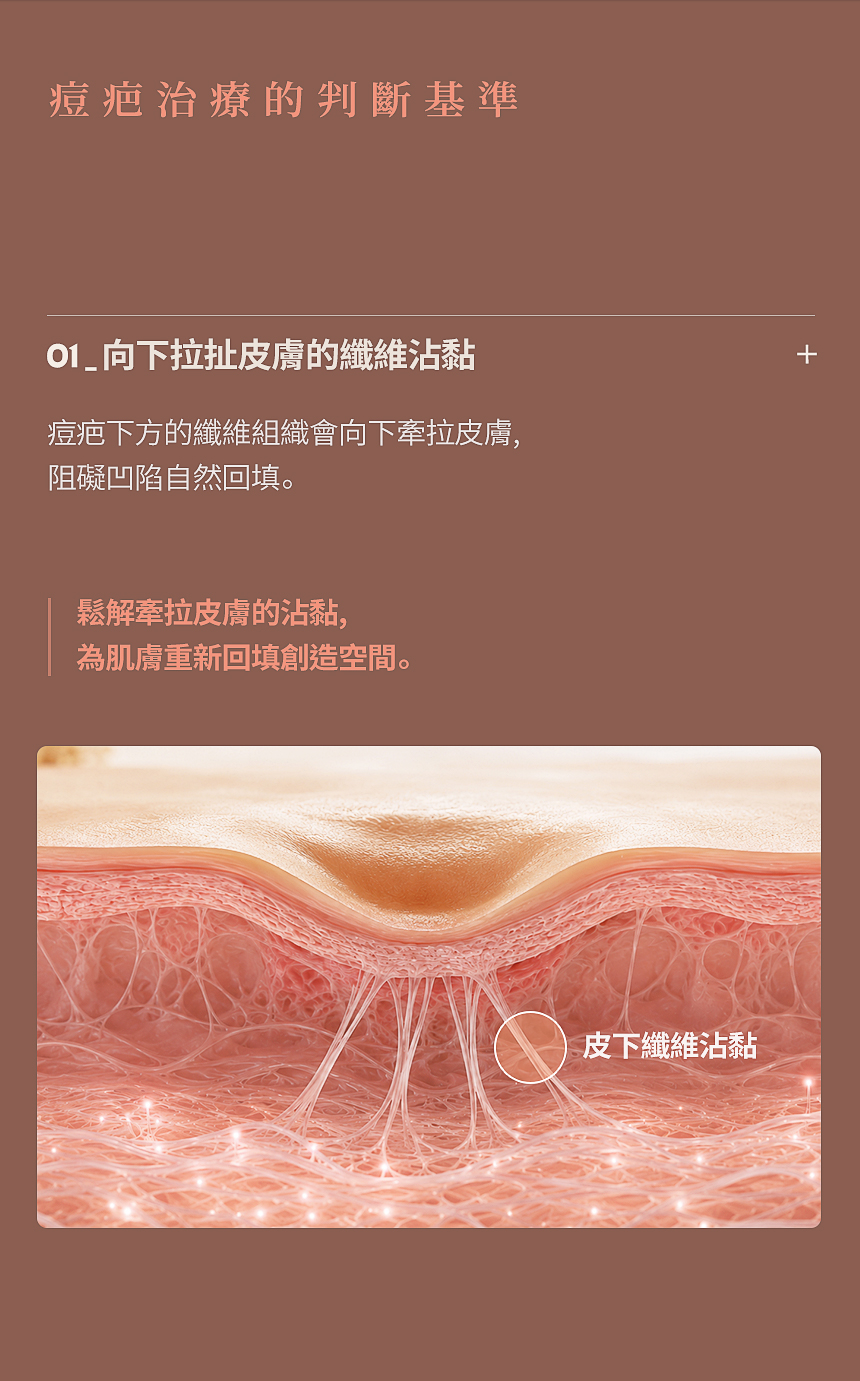 痘疤纖維沾黏鬆解治療