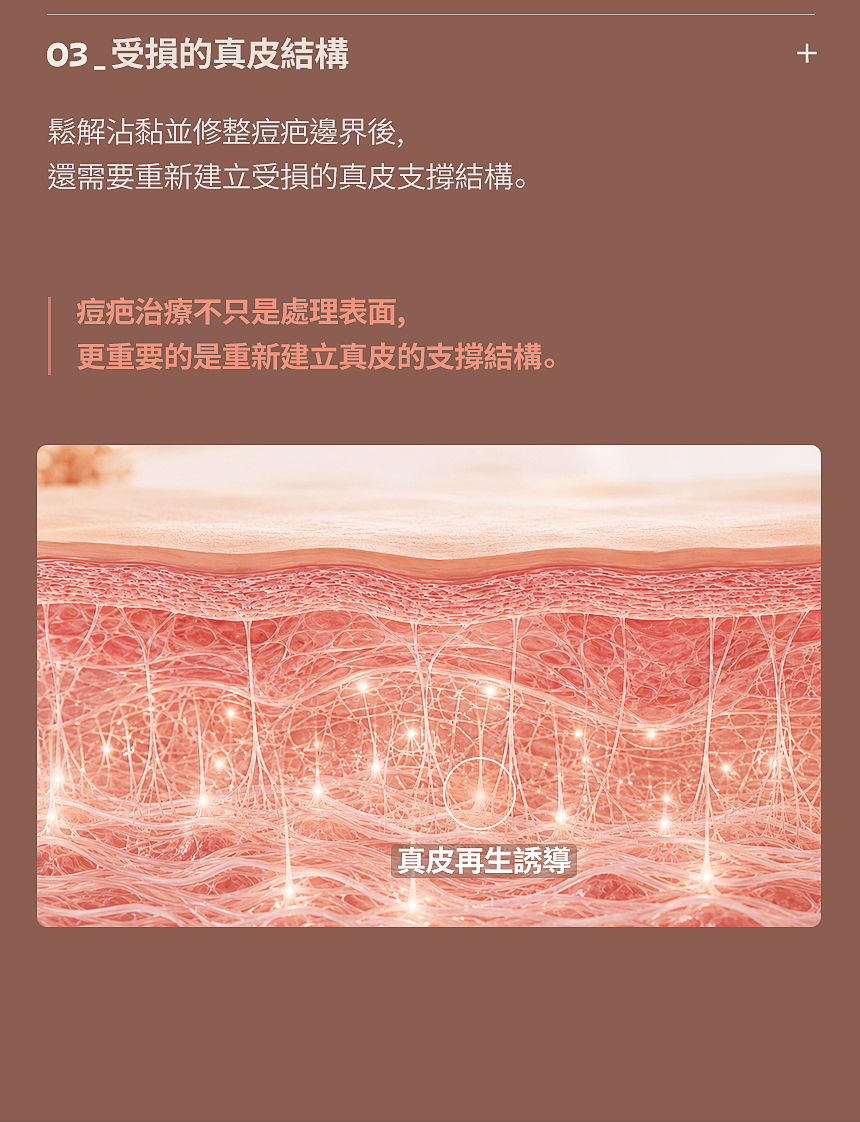 痘疤受損真皮結構再生治療