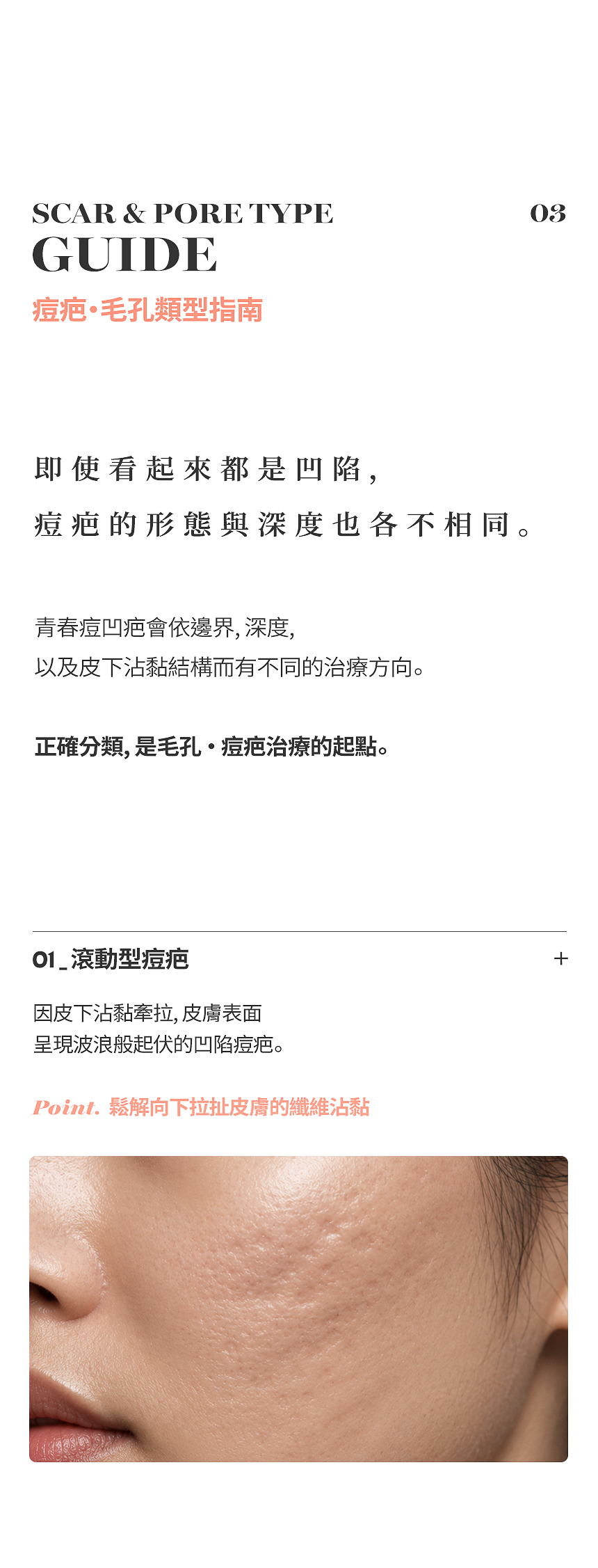 痘疤・毛孔類型與治療指南