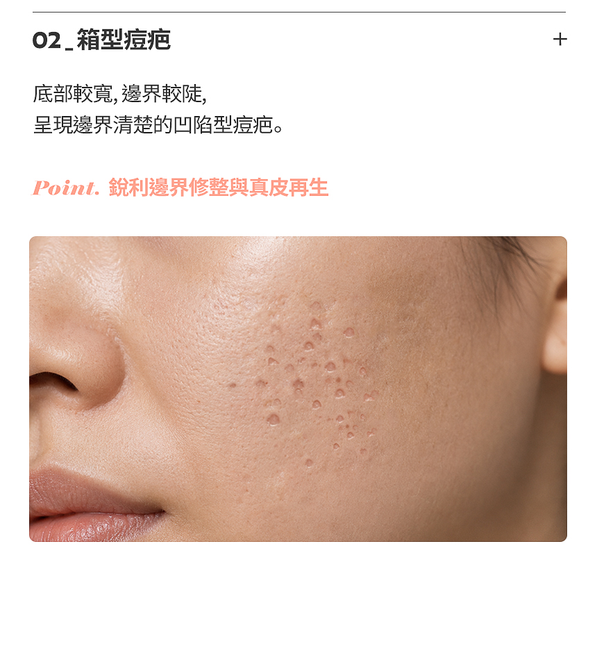 滾動型痘疤凹陷治療