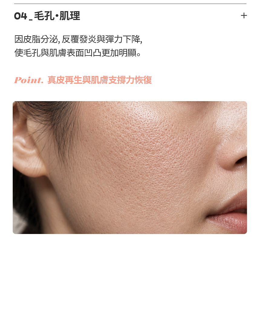 冰鑿型深層痘疤治療