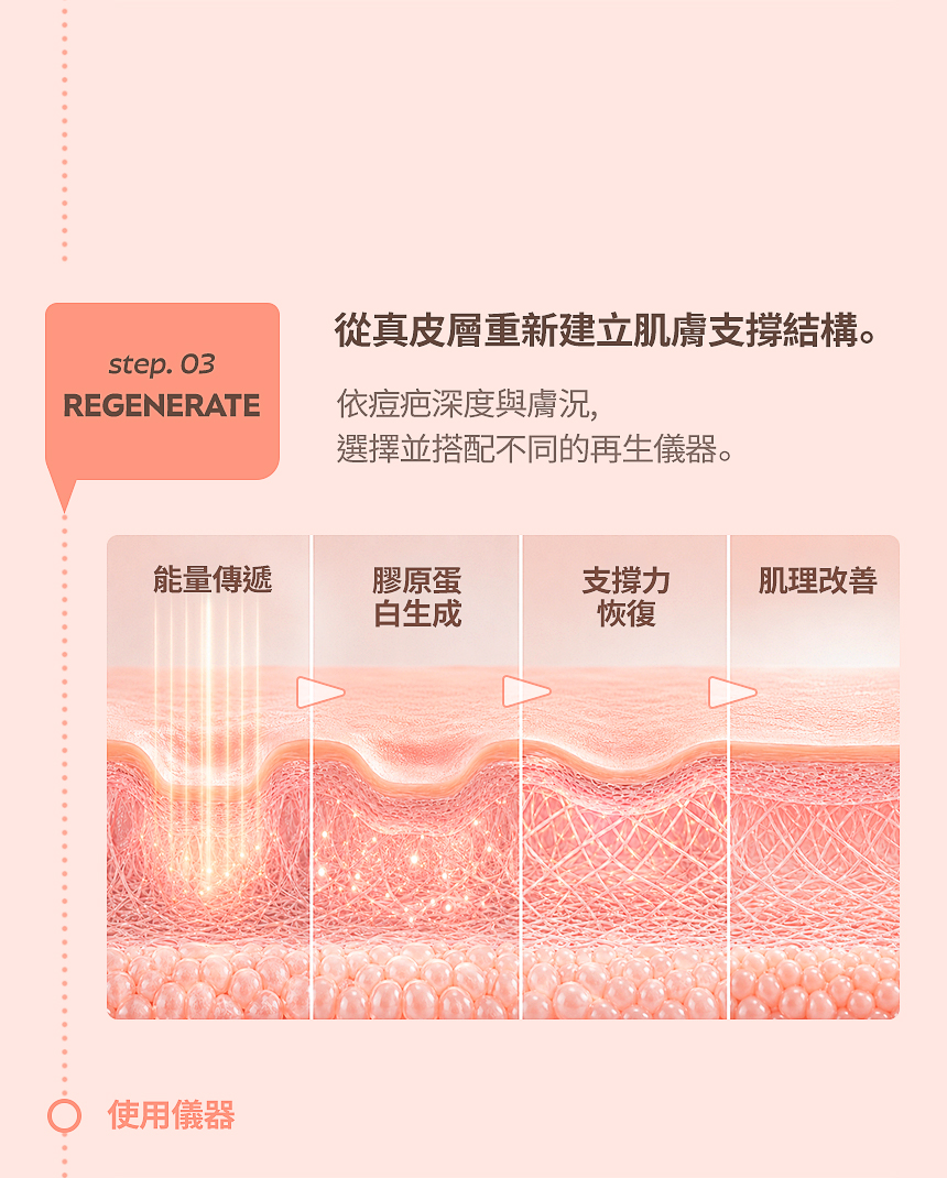 痘疤・毛孔真皮與膠原蛋白再生治療