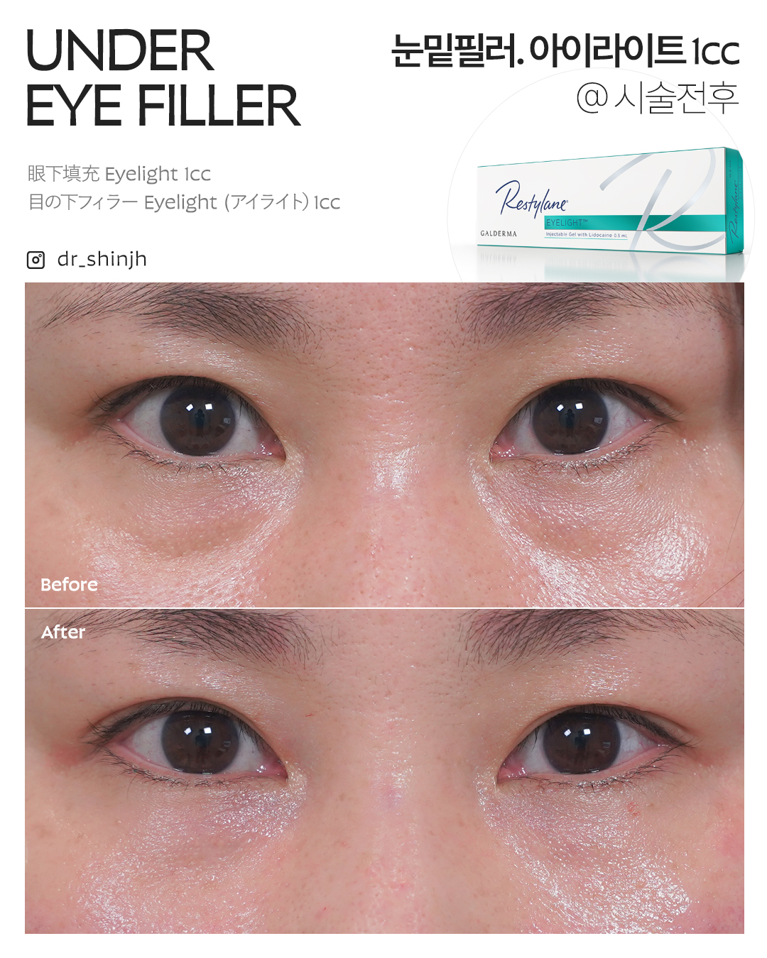 FLORIA Clinic 术前术后照片
