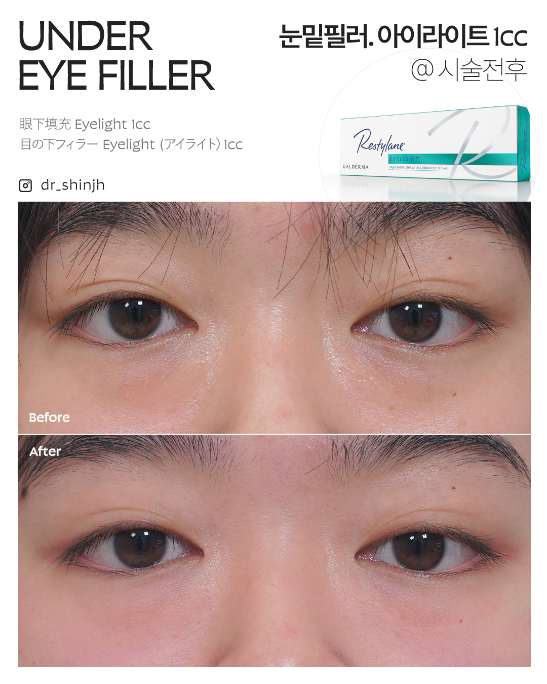 FLORIA Clinic 术前术后照片