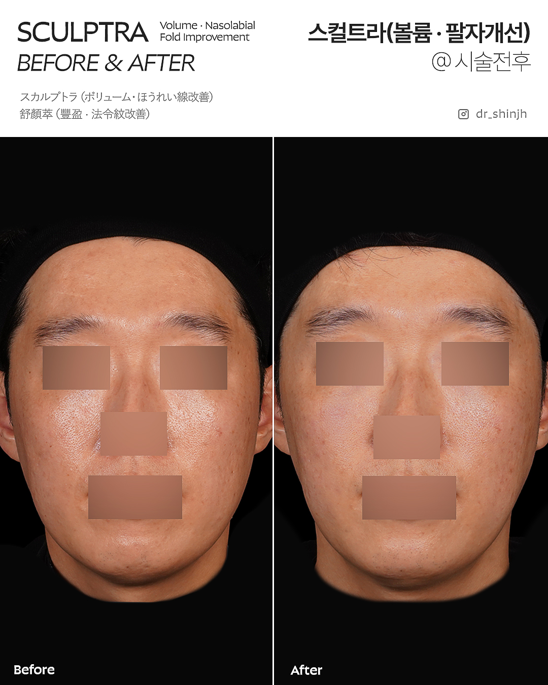 FLORIA Clinic 术前术后照片